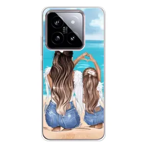 Чехол с печатью для Xiaomi 15 - (Мама с ребенком) (AlphaPrint) (Мама с доченькой)