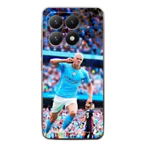 Чехлы с футболистом Ерлинг Холанд для Xiaomi 15T (AlphaPrint) (фанаты Холанда)