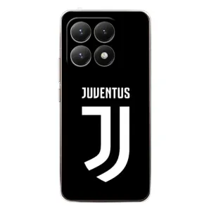 Чохли для Xiaomi 15T (VPrint) - Футбольні клуби (ФК Ювентус)