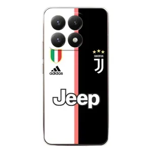 Чохли для Xiaomi 15T (VPrint) - Футбольні клуби (Juventus)