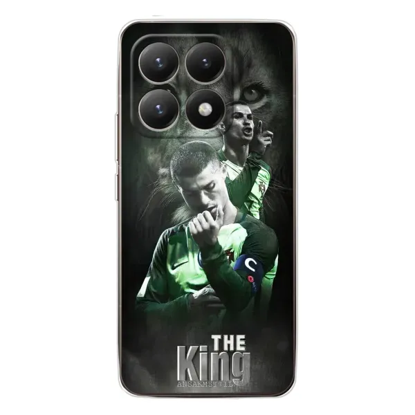 Чехол с принтом «Криштиано Лев» для Xiaomi 15T Чехол с принтом «Криштиано Лев» для Xiaomi 15T