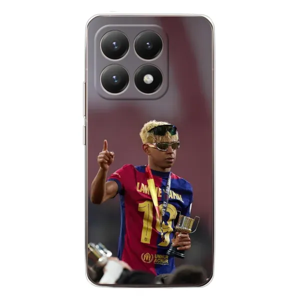 Чехол с принтом «Lamine Yamal» для Xiaomi 15T Чехол с принтом «Lamine Yamal» для Xiaomi 15T