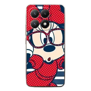 Эксклюзивный чехол для Xiaomi 15T (AlphaPrint - Мультяшные) (Маус в очках)