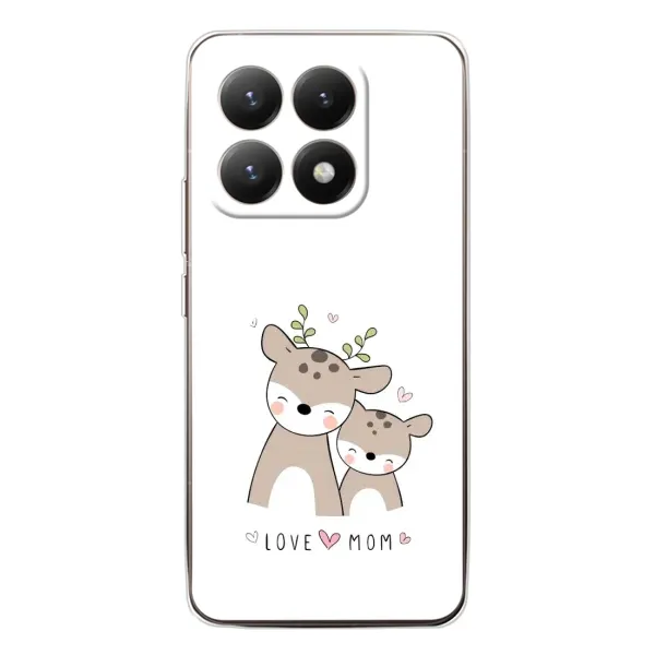 Чехол с принтом «Оленята мама и малыш» для Xiaomi 15T Чехол с принтом «Оленята мама и малыш» для Xiaomi 15T