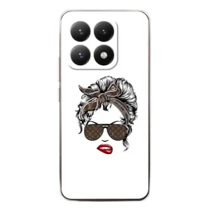 Чехлы Луи Витон для Xiaomi 15T (AlphaPrint - LOUIS VUITTON) (стильная с луи витон)
