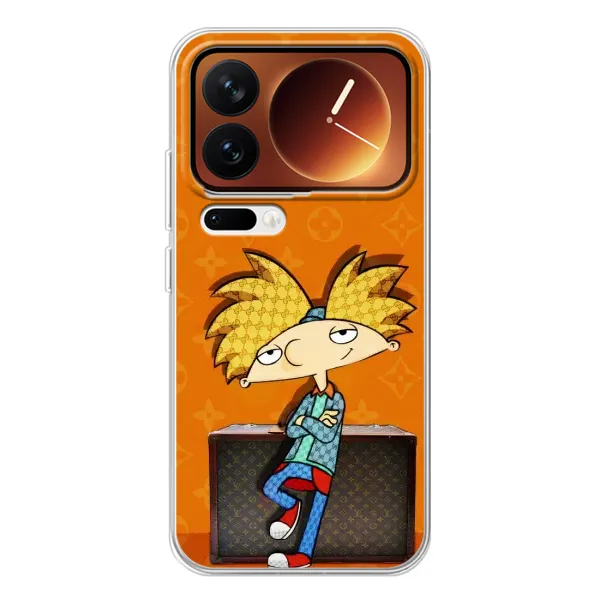 Чехол с принтом «Арнольд» для Xiaomi 17 Pro