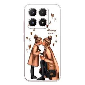Чохол з друком для Xiaomi 17 - (Мама з дитинкою) (AlphaPrint)