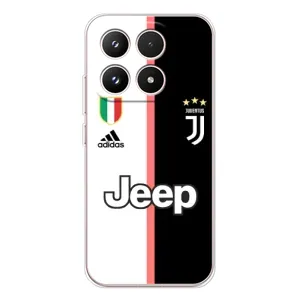 Чохли для Xiaomi 17 (VPrint) - Футбольні клуби (Juventus)