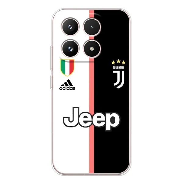Чохол з принтом «Juventus» для Xiaomi 17 Чохол з принтом «Juventus» для Xiaomi 17