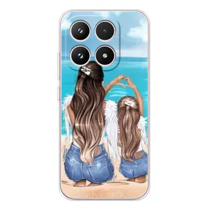 Чехол с печатью для Xiaomi 17 - (Мама с ребенком) (AlphaPrint) (Мама с доченькой)