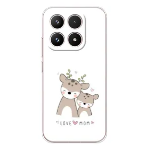 Чехлы для мамы на Xiaomi 17 (Оленята мама и малыш)
