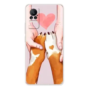 Чехлы с собаками для Xiaomi Civi 1S (VPrint) (Любовь к собакам)