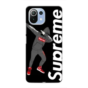 Чеохол для Xiaomi Mi 11 Lite з картинкою Supreme (AlphaPrint) (Деб Супрім)