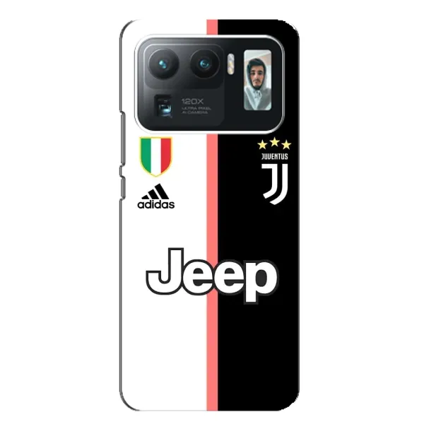 Чохол з принтом «Juventus» для Xiaomi Mi 11 Ultra