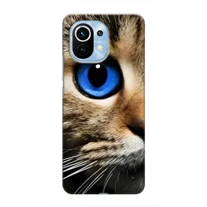 Чохли з Котиками для Xiaomi Mi 11 (VPrint) (Око кота)