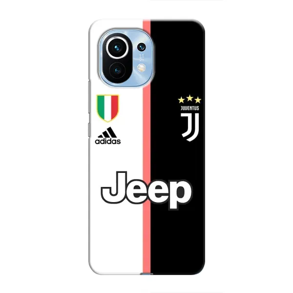 Чохол з принтом «Juventus» для Xiaomi Mi 11