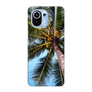 Силиконовый чехол с КАРТИНКАМИ лето для Xiaomi Mi 11 (AlphaPrint) (Пальма)