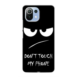 Чохол з принтом «Dont Touch» для Xiaomi Mi 11i