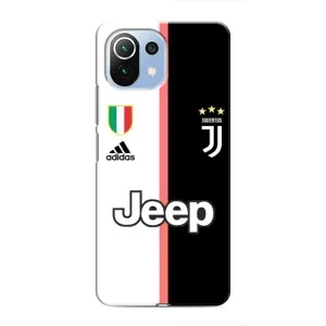 Чехлы для Xiaomi Mi 11i (VPrint) - Футбольные клубы (Juventus)