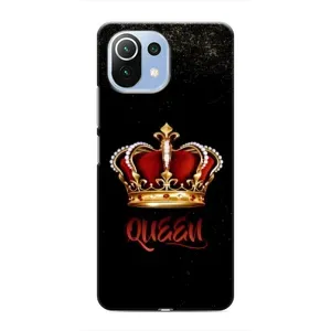 Чохол з Короною Ксяомі Мі 11і - (AlphaPrint) (Корона короля)