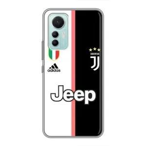 Чохли для Xiaomi Mi 12 Lite (VPrint) - Футбольні клуби (Juventus)