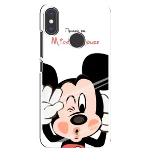 Эксклюзивный чехол для Xiaomi Mi A2 (AlphaPrint - Мультяшные) (Маус Микки)