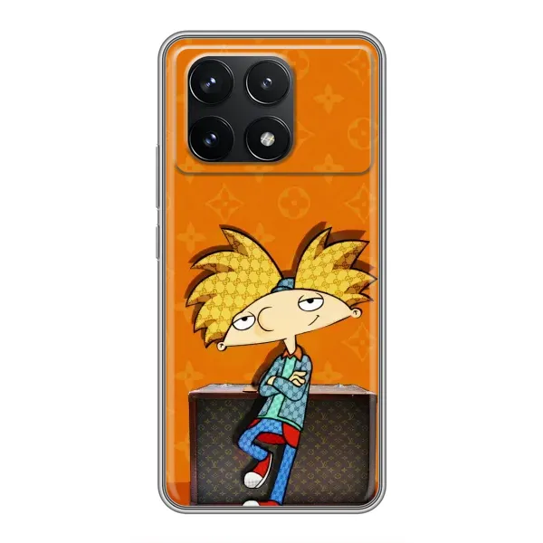 Чехол с принтом «Арнольд» для Xiaomi POCO F6 Pro