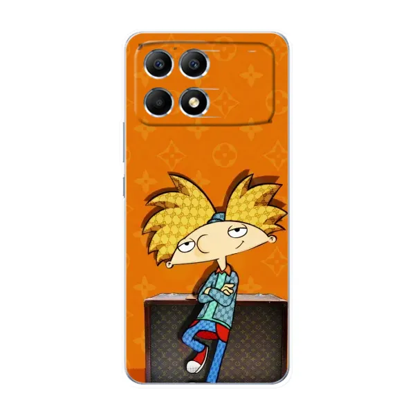 Чехол с принтом «Арнольд» для Xiaomi POCO F6