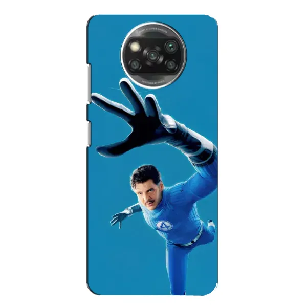 Чехол с принтом «Мистер Фантастик супергерой» для Xiaomi POCO X3 Pro Чехол с принтом «Мистер Фантастик супергерой» для Xiaomi POCO X3 Pro