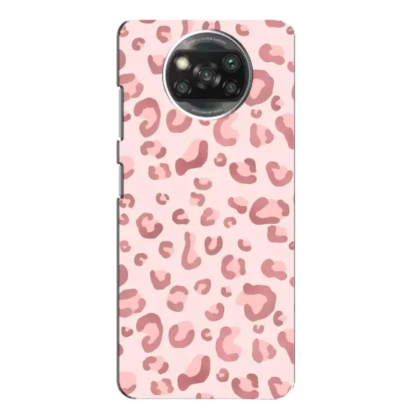 Чехол с принтом «Розовый леопард» для Xiaomi POCO X3 Чехол с принтом «Розовый леопард» для Xiaomi POCO X3