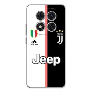 Чехлы для Xiaomi POCO X7 (VPrint) - Футбольные клубы (Juventus)