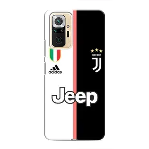 Чохли для Xiaomi Redmi Note 10 Pro (VPrint) - Футбольні клуби (Juventus)
