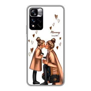 Чохол з друком для Xiaomi Redmi Note 11 Pro Plus - (Мама з дитинкою) (AlphaPrint) (Донька і мама)