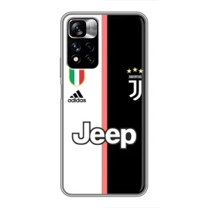 Чохли для Xiaomi Redmi Note 11 Pro Plus (VPrint) - Футбольні клуби (Juventus)