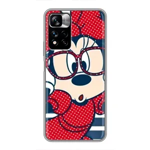 Міккі Маус чохол для Xiaomi Redmi Note 11 Pro Plus (AlphaPrint - Мультяшні) (Маус в окулярах)