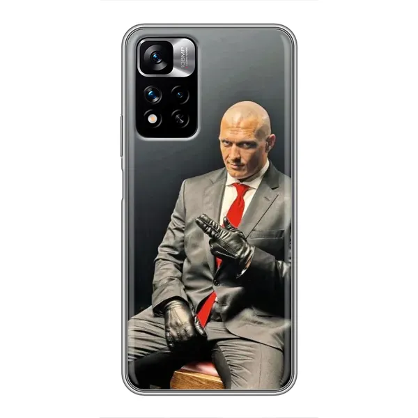Чехол с принтом «Усик Hitman» для Xiaomi Redmi Note 11 Pro Plus