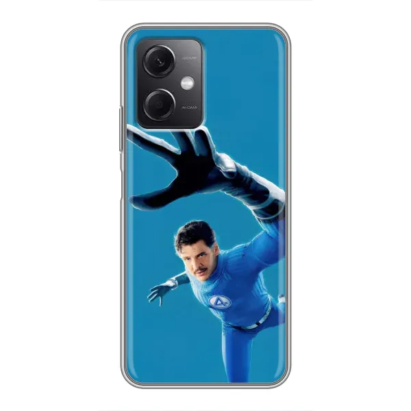 Чехол с принтом «Мистер Фантастик супергерой» для Xiaomi Redmi Note 12 (5G) Чехол с принтом «Мистер Фантастик супергерой» для Xiaomi Redmi Note 12 (5G)