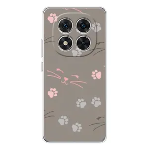 Чехол с рисунком кот на Xiaomi Redmi Note 14 Pro (Лапы и усы)