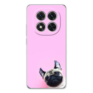 Чехлы с собаками для Xiaomi Redmi Note 14 Pro (VPrint) (Смешная собака)