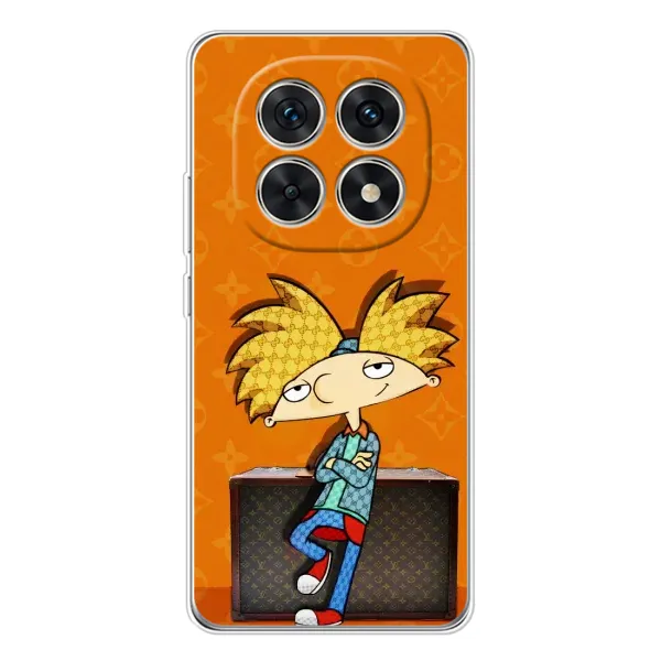 Чохол з принтом «Арнольд» для Xiaomi Redmi Note 15 5G