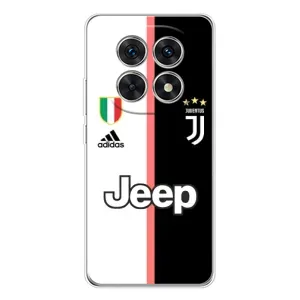 Чехлы для Xiaomi Redmi Note 15 5G (VPrint) - Футбольные клубы (Juventus)