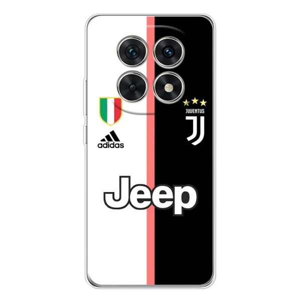 Чехол с принтом «Juventus» для Xiaomi Redmi Note 15 5G