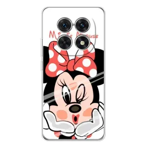 Эксклюзивный чехол для Xiaomi Redmi Note 15 5G (AlphaPrint - Мультяшные) (Маус Минни)