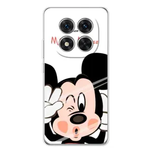 Эксклюзивный чехол для Xiaomi Redmi Note 15 Pro Plus (AlphaPrint - Мультяшные) (Маус Микки)