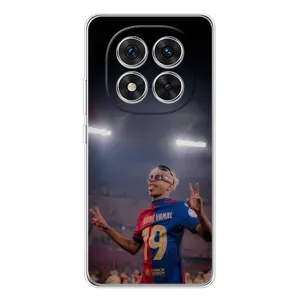 Чехол с футболистом Ламин Ямаль Xiaomi Redmi Note 15 Pro Plus (Ямаль на стадионе)