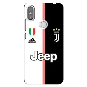 Чохли для Xiaomi Redmi S2 (VPrint) - Футбольні клуби (Juventus)