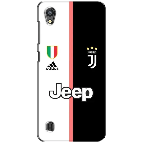Чехол с принтом «Juventus» для ZTE Blade A5 Чехол с принтом «Juventus» для ZTE Blade A5