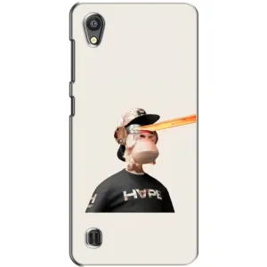 Чохли з Мавпами NFT для ZTE Blade A5 (AlphaPrint) (мавпа NFT в окулярах)