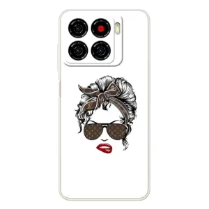 Чехлы Луи Витон для ZTE Blade A56 (AlphaPrint - LOUIS VUITTON) (стильная с луи витон)