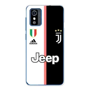 Чохли для ZTE Blade L9 (VPrint) - Футбольні клуби (Juventus)